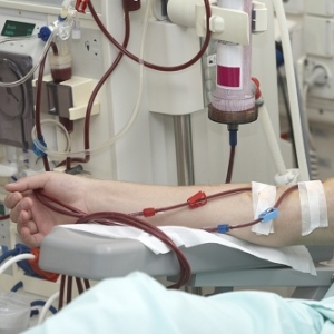 Современное отделение амбулаторного гемодиализа откроется на базе ростовской областной клинической больницы № 2 в третьем квартале 2014 года, сообщает пресс-служба губернатора