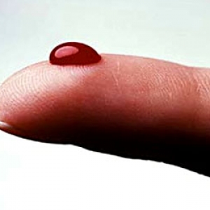 28 марта 2014 года в Ростове-на-Дону и ещё 14 регионах РФ состоится Всероссийская социальная акция «День МНО»